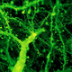 Branches of neurons in a mouse cortex